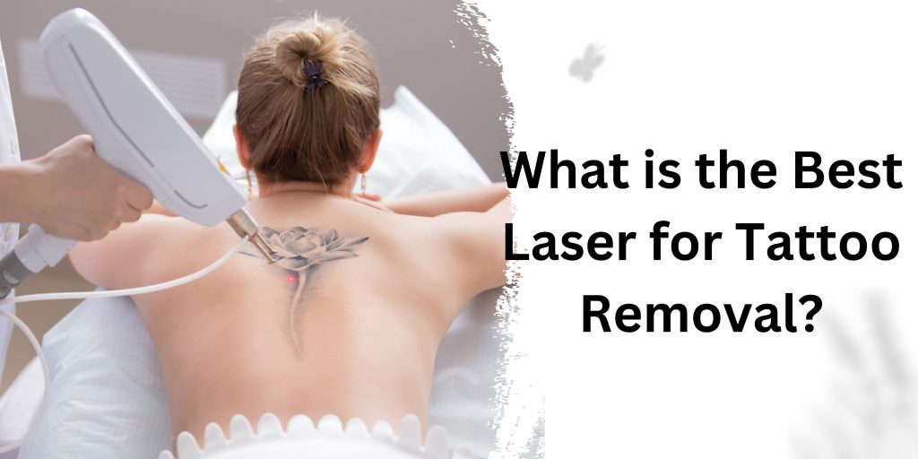 What is the Best Laser for Tattoo Removal