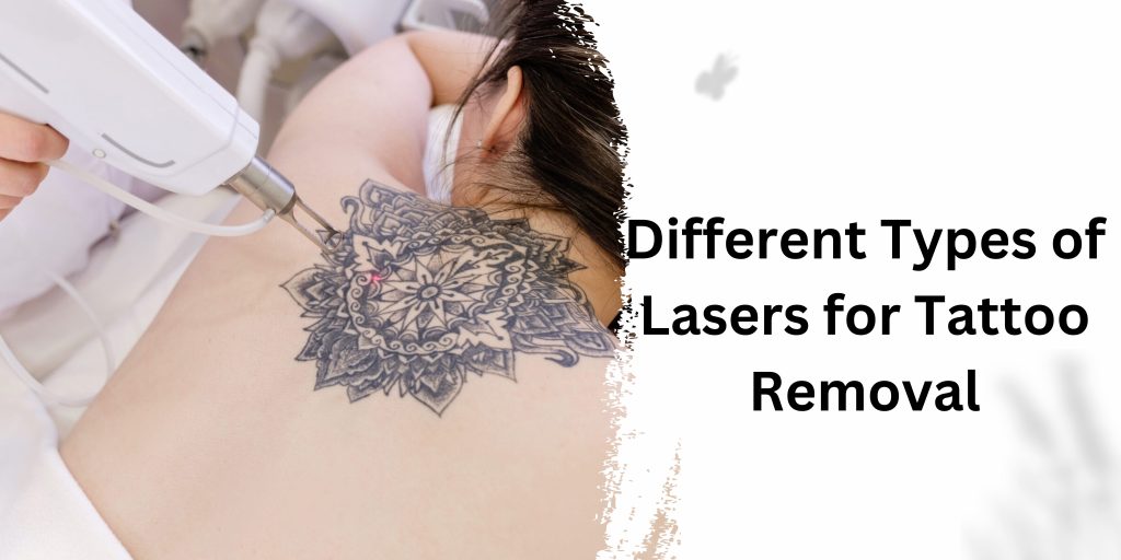 Different Types of Lasers for Tattoo Removal