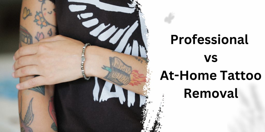 Professional vs. At-Home Tattoo Removal