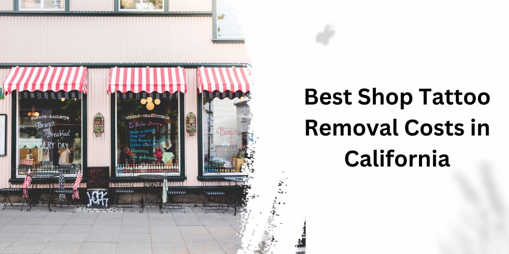 Best Shop Tattoo Removal Costs in California