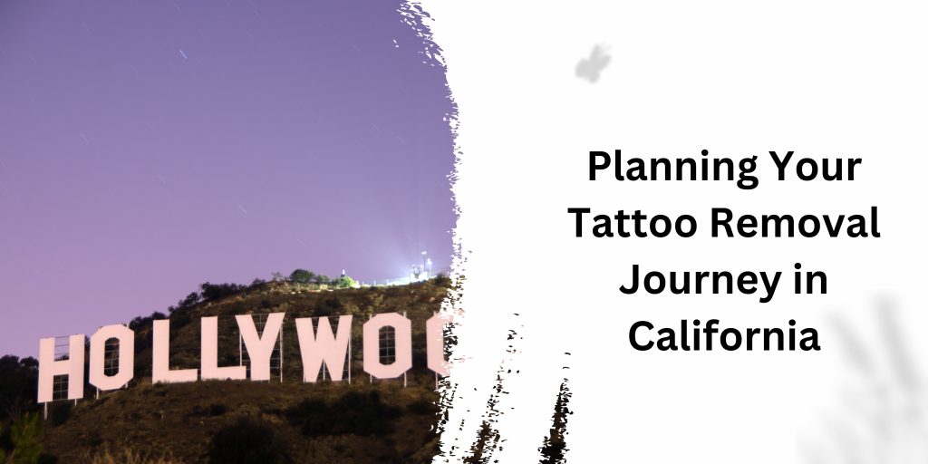 Tattoo Removal Journey in California
