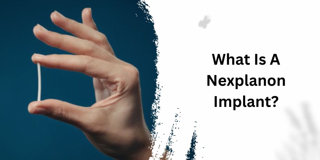 What Is A Nexplanon Implant