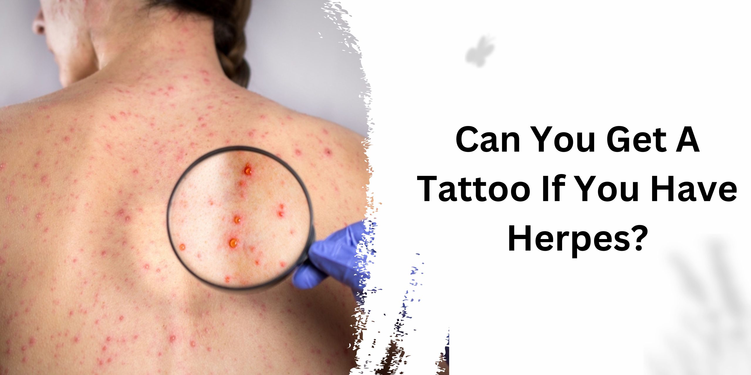 Can You Get A Tattoo If You Have Herpes