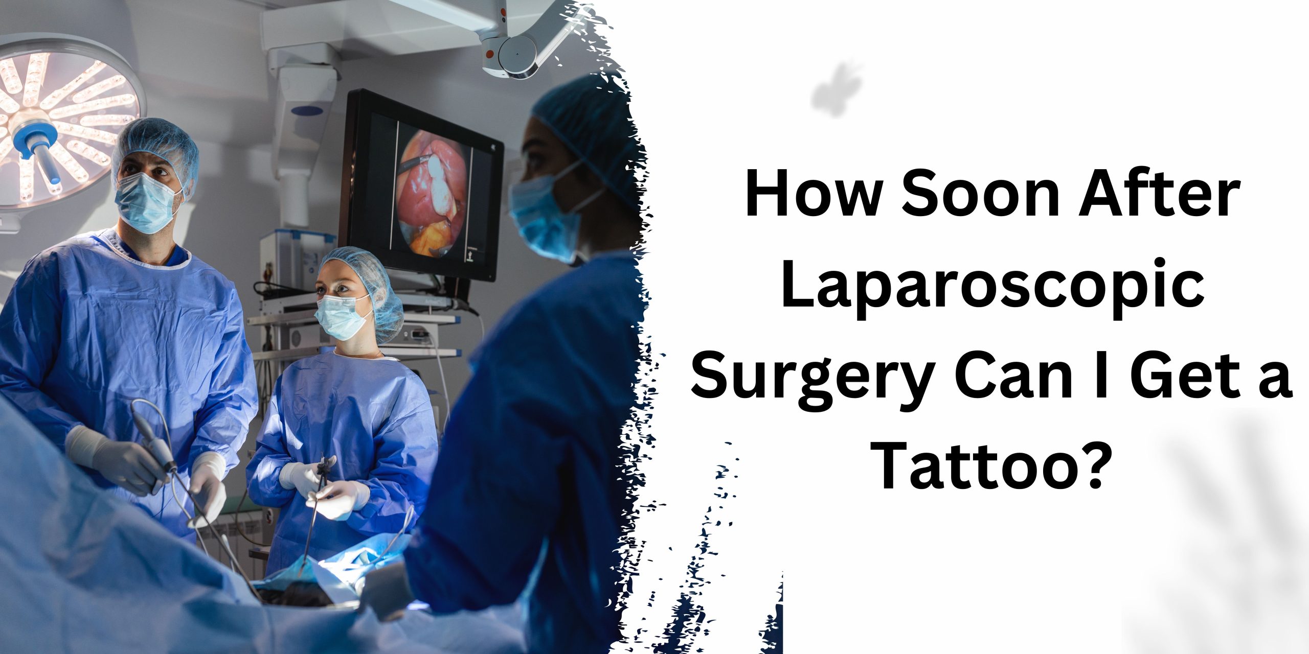How Soon After Laparoscopic Surgery Can I Get a Tattoo
