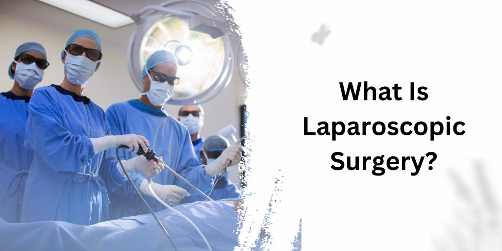 What Is Laparoscopic Surgery?